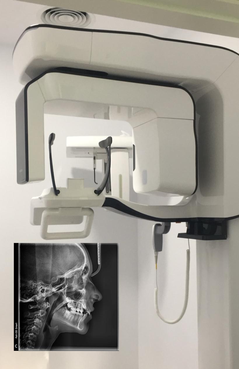 Scanner 3d